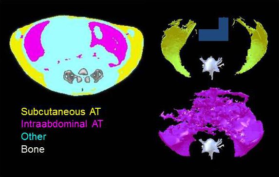 Computer-tomographischer Querschnitt durch das Abdomen einer Ratte, welcher das subkutane (gelb) und intraabdominale (violett)  Fettgewebe zeigt.