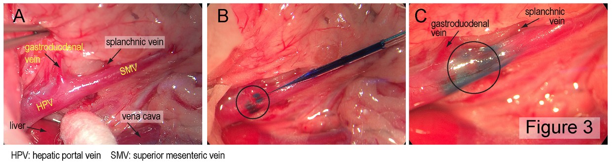 Abbildung 2: Injektionsstelle und Beispiel der HSV1-129 Injektion in die Wand der hepatischen Pfortader.