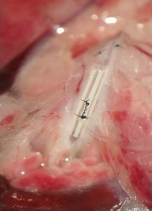 Figure 2: Magnified in situ view of the anatomical organization after preparation. It shows the mesenteric lymph duct after implantation of the Vialon tubing (Arnold et al., Am J Physiol 302:R1365–R1371, 2012).