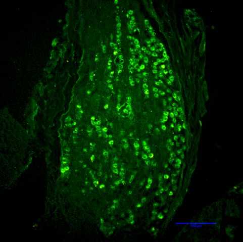 Enlarged view: Figure 2: Green Fluorescent Protein (GFP) expression in the nodose ganglion of a rat injected with GLP-1R–targeting lentiviral particles