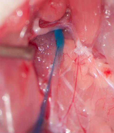 Figure 1: Novel technique for the microinjection of shRNA into a rat nodose ganglion, developed and for the first time used in-vivo by us. The nodose ganglia contain the cell bodies of the vagal afferents