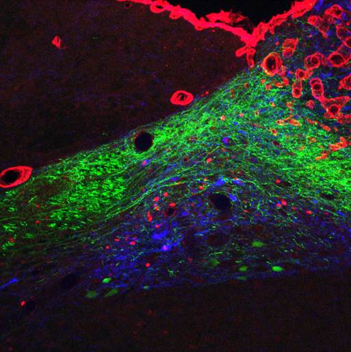 Enlarged view: Figure 4: Triple labeling of the Nucleus tractus solitarii of a rat after intraperitoneal injection of Exendin-4 and microinjection of an AAV-GFP virus (green) in to the nodose ganglion.  Red: c-Fos, blue: dopamine-beta-hydroxylase.  